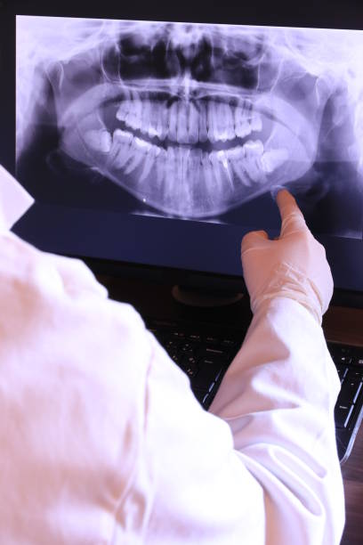 Best Emergency Cosmetic Dentistry (e.g., broken veneers) in Bluffton, OH